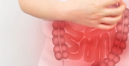 Medical illustration of inflamed intestines overlaid on a person's abdomen