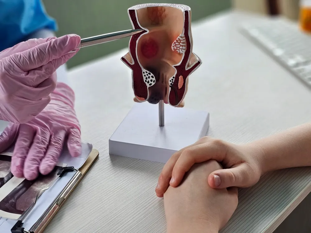 Colorectal surgeon explaining what colonoscopy is to patient using an anatomical model of a rectum
